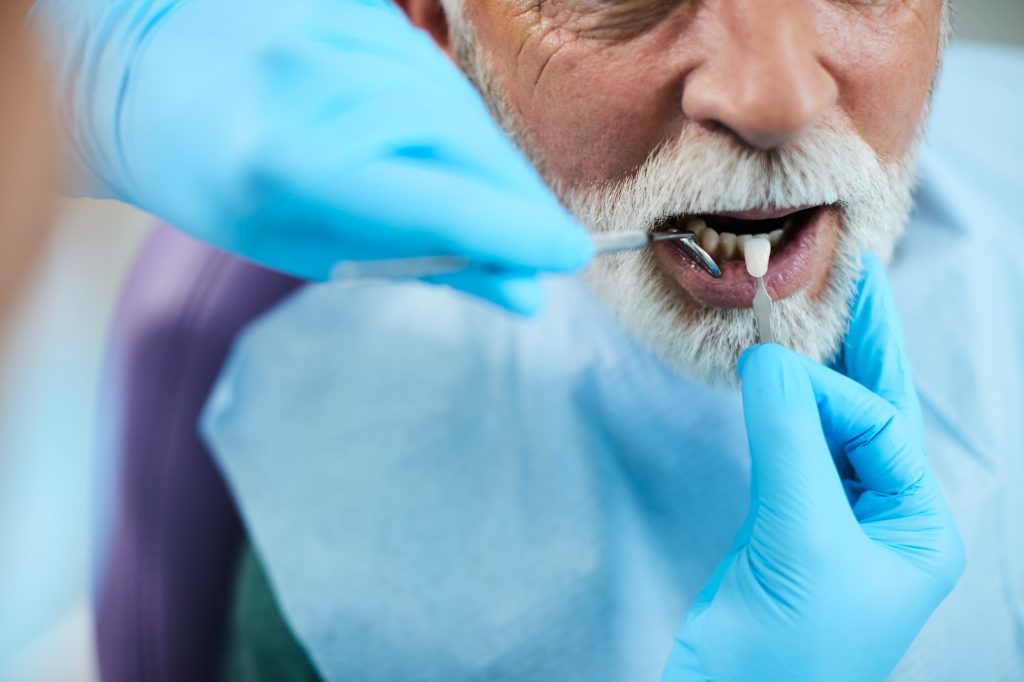 Close up of dentist implanting dental veneers on senior patient.
